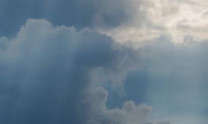 Röntgenaufnahme eines menschlichen Beckens